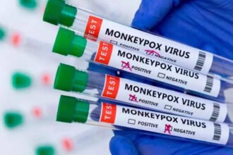 Britain detects two extra circumstances of latest mpox variant – ET HealthWorld